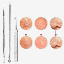 Carica l&#39;immagine nel visualizzatore di Gallery, Face Cleaning Comedone Extractor Pore Cleaner
